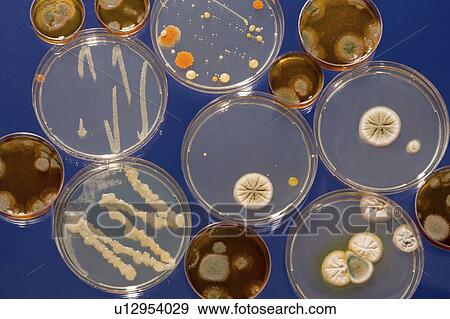 Stock Photo - Cultures growing on Petri dishes.. Fotosearch