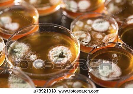 Stock Photo - Cultures growing on Petri dishes.. Fotosearch