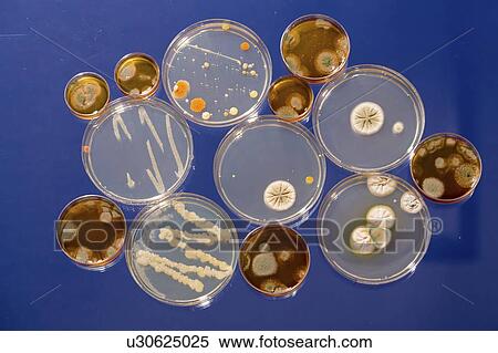 Stock Photography - Cultures growing on Petri dishes.. Fotosearch