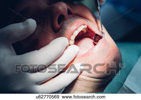 Stock Photo - Dentist carrying out dental procedure on male patient, close-up. Fotosearch