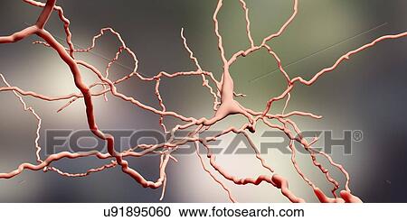 Stock Image - Dopaminergic neuron, computer illustration. Dopaminergic neurons are brain cells whose primary neurotransmitter is dopamine. Degeneration of these cells leads to the symptoms of Parkinson's disease. These symptoms include tremor, muscular rigidity,.... Fotosearch