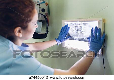 Stock Image - Female dentist looking at dental x-ray on lightbox. Fotosearch