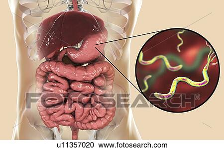 Helicobacter pylori bacteria. Computer illustration of Helicobacter pylori bacteria in a human stomach. Formerly known as Campylobacter pyloridis, these are spiral-shaped Gram-negative bacteria. The terminal flagella (hair-like structures) are used... View Large Photo Image Stock Image - Helicobacter pylori bacteria. Computer illustration of Helicobacter pylori bacteria in a human stomach. Formerly known as Campylobacter pyloridis, these are spiral-shaped Gram-negative bacteria. The terminal flagella (hair-like structures) are used.... Fotosearch