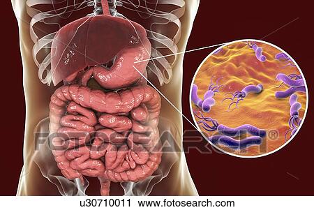 Helicobacter pylori bacteria. Computer illustration of Helicobacter pylori bacteria in a human stomach. Formerly known as Campylobacter pyloridis, these are spiral-shaped Gram-negative bacteria. The terminal flagella (hair-like structures) are used... View Large Photo Image Stock Image - Helicobacter pylori bacteria. Computer illustration of Helicobacter pylori bacteria in a human stomach. Formerly known as Campylobacter pyloridis, these are spiral-shaped Gram-negative bacteria. The terminal flagella (hair-like structures) are used.... Fotosearch