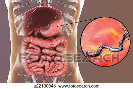 Helicobacter pylori bacteria. Computer illustration of Helicobacter pylori bacteria in a human stomach. Formerly known as Campylobacter pyloridis, these are spiral-shaped Gram-negative bacteria. The terminal flagella (hair-like structures) are used... View Large Photo Image Stock Photography - Helicobacter pylori bacteria. Computer illustration of Helicobacter pylori bacteria in a human stomach. Formerly known as Campylobacter pyloridis, these are spiral-shaped Gram-negative bacteria. The terminal flagella (hair-like structures) are used.... Fotosearch
