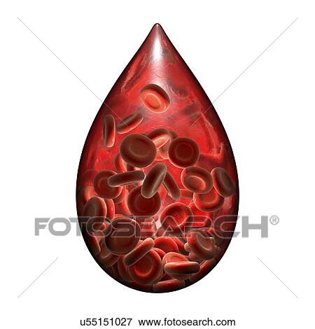 Stock Photo - Hemophilia, conceptual illustration.. Fotosearch