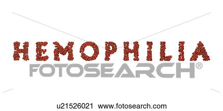 Hemophilia text made of red blood cells, computer illustration. View Large Photo Image Stock Image - Hemophilia text made of red blood cells, computer illustration.. Fotosearch
