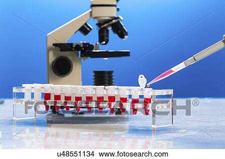 Picture - Identification of pathogenic microbes and viruses.. Fotosearch