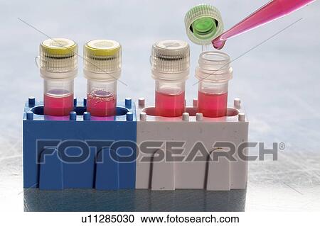 Stock Image - Identification of pathogenic microbes and viruses.. Fotosearch