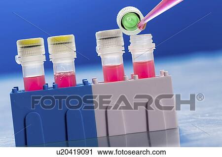 Stock Image - Identification of pathogenic microbes and viruses.. Fotosearch