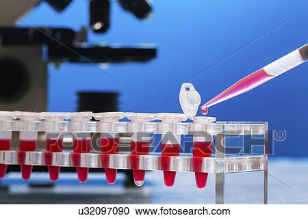 Stock Image - Identification of pathogenic microbes and viruses.. Fotosearch