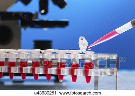 Stock Image - Identification of pathogenic microbes and viruses.. Fotosearch
