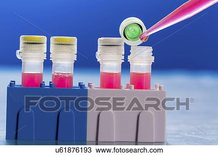 Identification of pathogenic microbes and viruses. View Large Photo Image Stock Image - Identification of pathogenic microbes and viruses.. Fotosearch