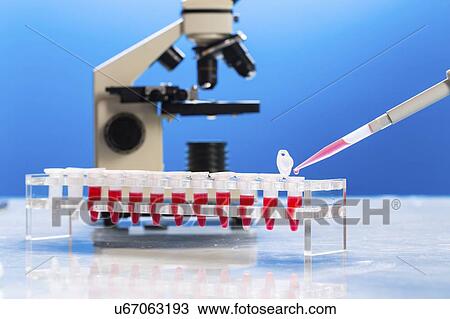 Stock Image - Identification of pathogenic microbes and viruses.. Fotosearch