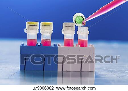 Identification of pathogenic microbes and viruses. View Large Photo Image Stock Image - Identification of pathogenic microbes and viruses.. Fotosearch