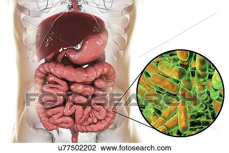 Stock Image - Illustration of Bifidobacterium bacteria in the human intestine. This Gram-positive anaerobic bacteria is the main component of the human large intestine microbiome. It has a unique hexose (sugar) metabolism, called the bifid shunt, which can be used.... Fotosearch