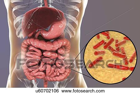 Stock Photograph - Illustration of Bifidobacterium bacteria in the human intestine. This Gram-positive anaerobic bacteria is the main component of the human large intestine microbiome. It has a unique hexose (sugar) metabolism, called the bifid shunt, which can be used.... Fotosearch
