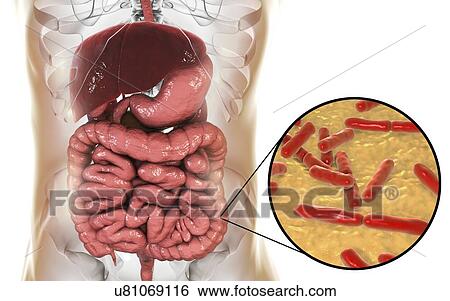 Stock Photograph - Illustration of Bifidobacterium bacteria in the human intestine. This Gram-positive anaerobic bacteria is the main component of the human large intestine microbiome. It has a unique hexose (sugar) metabolism, called the bifid shunt, which can be used.... Fotosearch