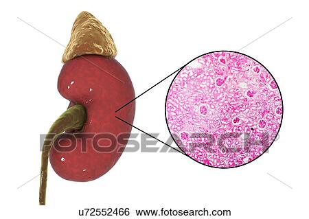 Illustration of human kidney and light micrograph of a section through a kidney cortex showing glomeruli (small round). A glomerulus forms part of the kidney's functional unit, the nephron, of which there are about one million in a kidney. A... View Large Photo Image Stock Photograph - Illustration of human kidney and light micrograph of a section through a kidney cortex showing glomeruli (small round). A glomerulus forms part of the kidney's functional unit, the nephron, of which there are about one million in a kidney. A.... Fotosearch