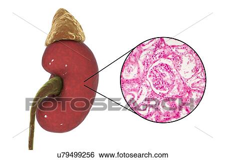 Stock Photograph - Illustration of human kidney and light micrograph of a section through a kidney cortex showing a glomerulus (round). A glomerulus forms part of the kidney's functional unit, the nephron, of which there are about one million in a kidney. A glomerulus.... Fotosearch