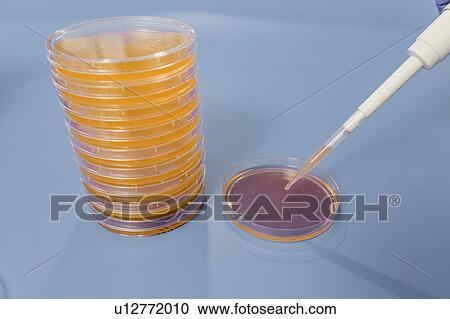 Inoculating agar plate. View Large Photo Image Stock Image - Inoculating agar plate.. Fotosearch
