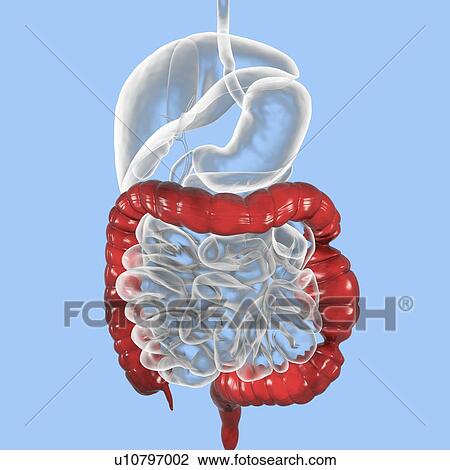 Stock Image - Irritable bowel syndrome. Illustration of a digestive system suffering from irritable bowel syndrome (IBS). IBS is also known as spastic colon or irritable colon syndrome. It causes abdominal pain and cramps, and irregular bowel habits such as.... Fotosearch