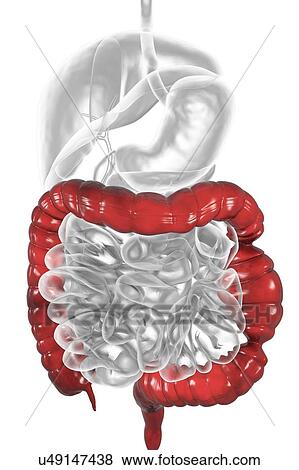 Stock Photo - Irritable bowel syndrome. Illustration of a digestive system suffering from irritable bowel syndrome (IBS). IBS is also known as spastic colon or irritable colon syndrome. It causes abdominal pain and cramps, and irregular bowel habits such as.... Fotosearch