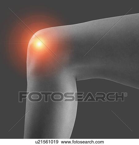 Stock Photo - Knee pain, conceptual image.. Fotosearch