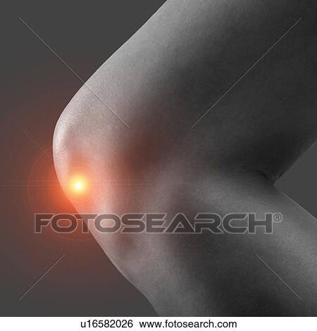 Stock Photograph - Knee pain, conceptual image.. Fotosearch