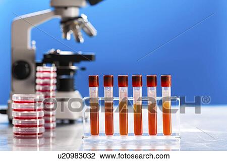 Microbiology research. View Large Photo Image Stock Image - Microbiology research.. Fotosearch