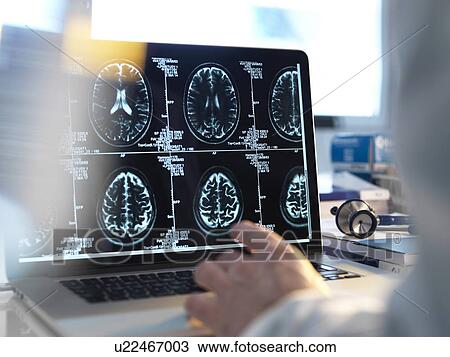 MODEL RELEASED. Doctor viewing a patient's brain scans on a computer screen. View Large Photo Image Stock Image - MODEL RELEASED. Doctor viewing a patient's brain scans on a computer screen.. Fotosearch