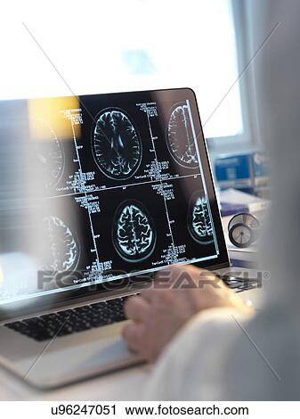 Stock Image - MODEL RELEASED. Doctor viewing a patient's brain scans on a computer screen.. Fotosearch
