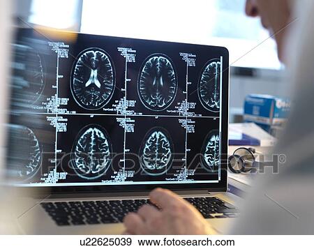 MODEL RELEASED. Doctor viewing a patient's brain scans on a computer screen. View Large Photo Image Stock Photo - MODEL RELEASED. Doctor viewing a patient's brain scans on a computer screen.. Fotosearch