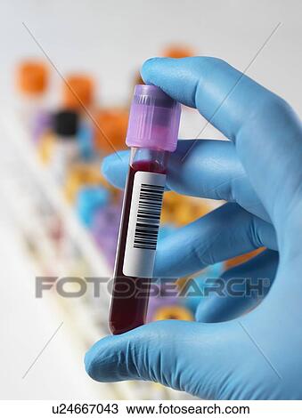 MODEL RELEASED. Technician holding a blood sample with a variety of human samples in a rack awaiting clinical testing. View Large Photo Image Stock Image - MODEL RELEASED. Technician holding a blood sample with a variety of human samples in a rack awaiting clinical testing.. Fotosearch