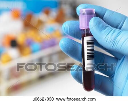 MODEL RELEASED. Technician holding a blood sample with a variety of human samples in a rack awaiting clinical testing. View Large Photo Image Stock Image - MODEL RELEASED. Technician holding a blood sample with a variety of human samples in a rack awaiting clinical testing.. Fotosearch