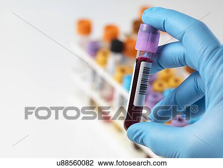 Stock Image - MODEL RELEASED. Technician holding a blood sample with a variety of human samples in a rack awaiting clinical testing.. Fotosearch