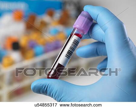 Stock Photo - MODEL RELEASED. Technician holding a blood sample with a variety of human samples in a rack awaiting clinical testing.. Fotosearch