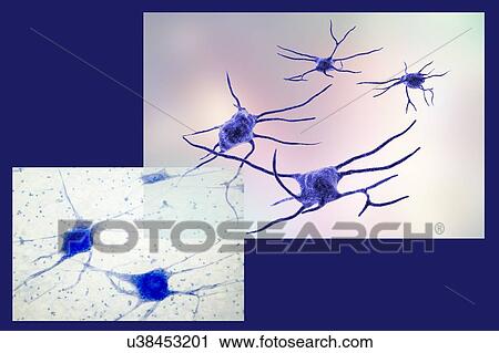 Stock Image - Nerve cells. Computer illustration and light micrograph of nerve cells, or neurons.. Fotosearch