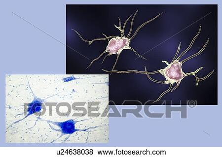 Nerve cells. Computer illustration and light micrograph of nerve cells, or neurons. View Large Photo Image Stock Photo - Nerve cells. Computer illustration and light micrograph of nerve cells, or neurons.. Fotosearch