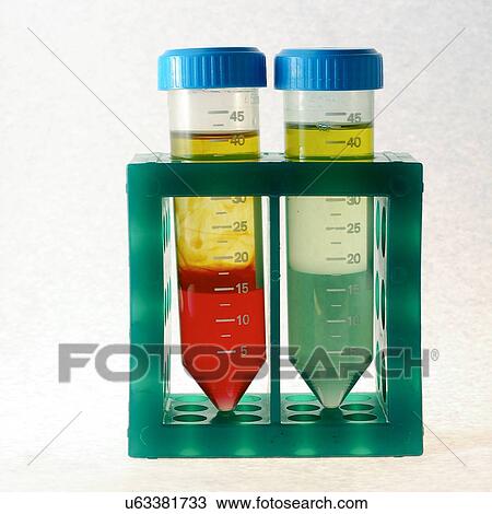 Stock Image - Phase separation in test tubes. These solutions have separated into their constituent liquids.. Fotosearch