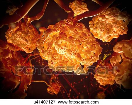Stock Photo - Renal corpuscles, illustration. Renal corpuscles filter the blood in the kidney. They are composed of a glomerulus and a Bowman's capsule. Small molecules pass from the bloodstream into the Bowman's capsule, and are then processed to filter waste.... Fotosearch