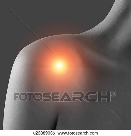 Stock Photography - Shoulder pain, conceptual image.. Fotosearch