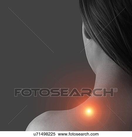 Stock Photography - Shoulder pain, conceptual image.. Fotosearch