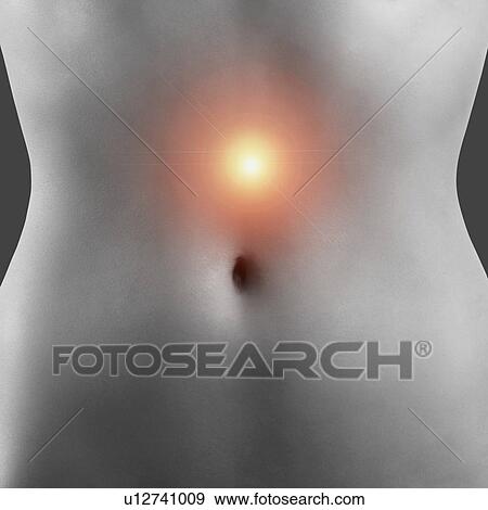 Stock Photo - Stomach pain, conceptual illustration.. Fotosearch