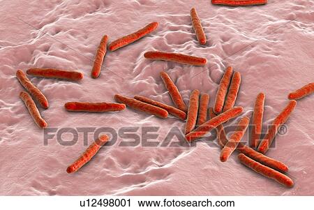 Stock Image - Tuberculosis bacteria. Computer illustration of Mycobacterium tuberculosis bacteria, the Gram-positive rod-shaped bacteria which cause the disease tuberculosis.. Fotosearch
