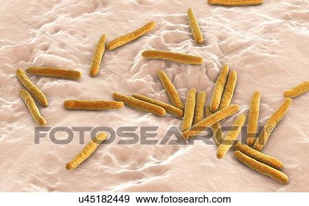 Tuberculosis bacteria. Computer illustration of Mycobacterium tuberculosis bacteria, the Gram-positive rod-shaped bacteria which cause the disease tuberculosis. View Large Photo Image Stock Photo - Tuberculosis bacteria. Computer illustration of Mycobacterium tuberculosis bacteria, the Gram-positive rod-shaped bacteria which cause the disease tuberculosis.. Fotosearch