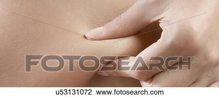 Stock Image - Weight loss, conceptual image.. Fotosearch