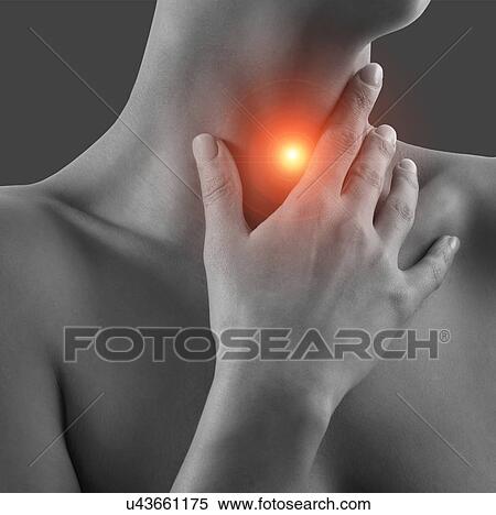 Stock Photography - Woman with sore throat, conceptual image.. Fotosearch
