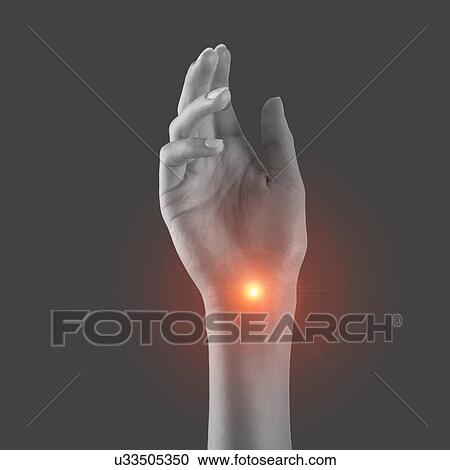 Wrist pain, conceptual image. View Large Photo Image Stock Image - Wrist pain, conceptual image.. Fotosearch