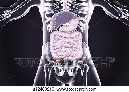 Appendicitis. Illustration of a human appendix, showing it red and inflamed in appendicitis. The appendix is a narrow finger-shaped tube that branches off the first part of the large intestine (caecum). Inflammation of the appendix in appendicitis is... View Large Photo Image Stock Image - Appendicitis. Illustration of a human appendix, showing it red and inflamed in appendicitis. The appendix is a narrow finger-shaped tube that branches off the first part of the large intestine (caecum). Inflammation of the appendix in appendicitis is.... Fotosearch